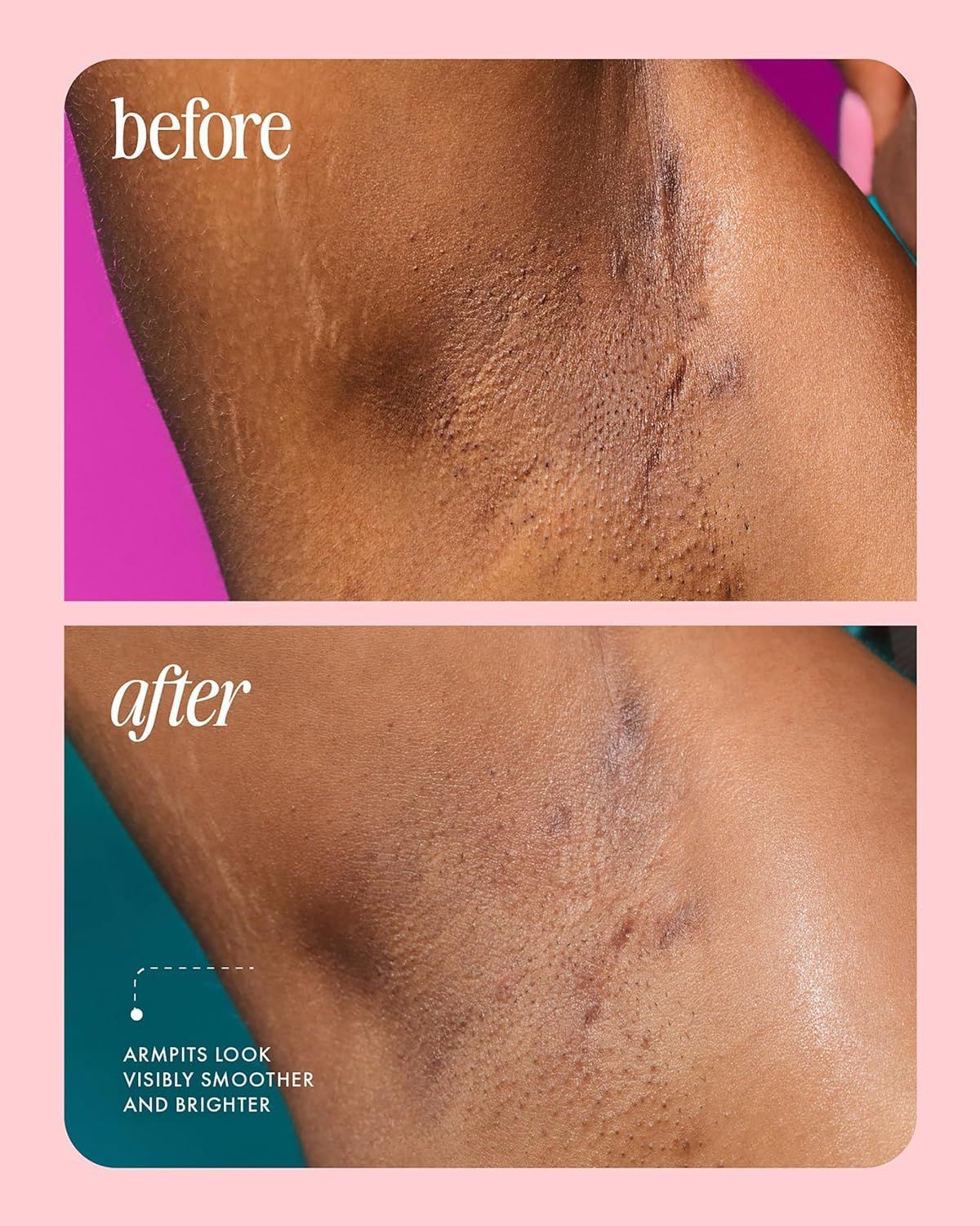 Truly Deodorant - Axilas más claras y frescas todos los días