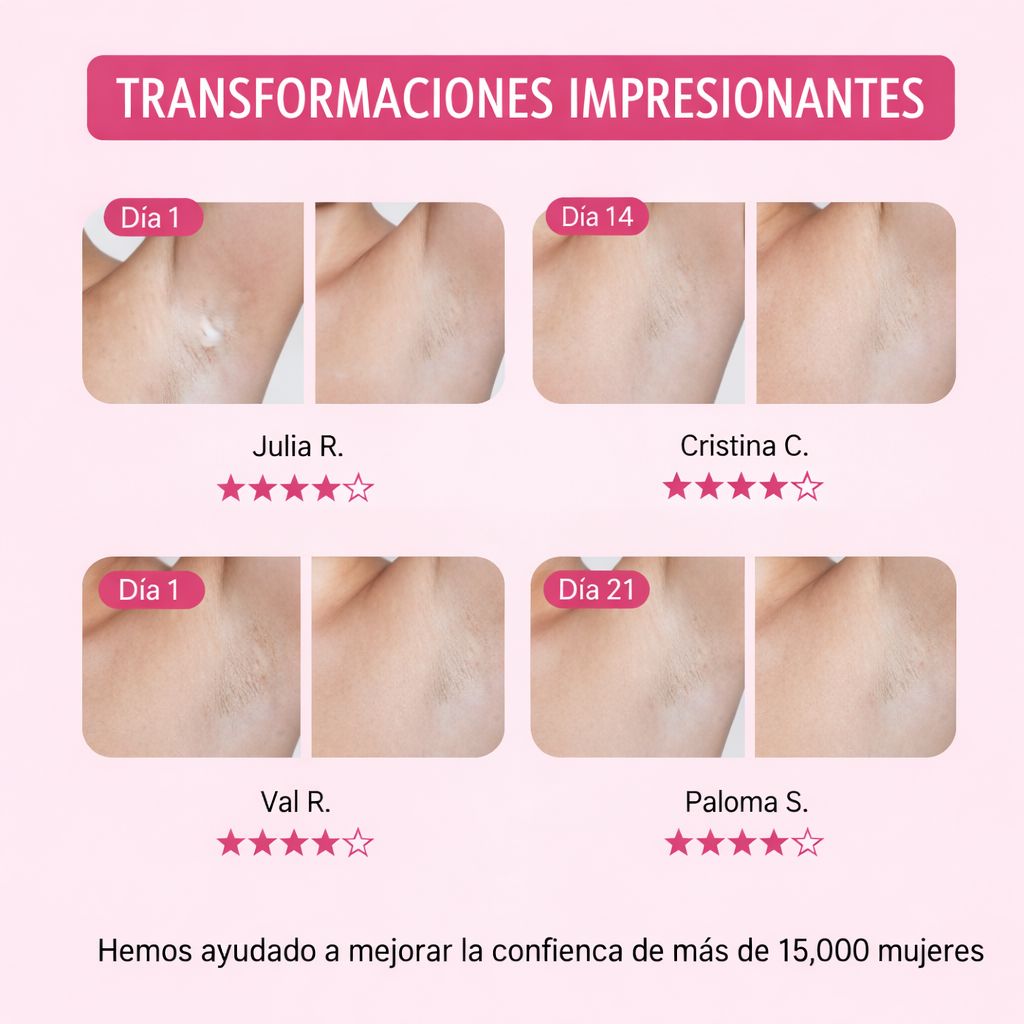 SkinGlow - Crema Aclarante