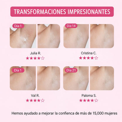 SkinGlow - Crema Aclarante